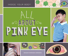 All about Pink Eye
