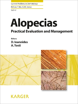 Alopecias - Practical Evaluation and Management - Ioannides, D. (Editor), and Tosti, A. (Editor), and Itin, P. (Series edited by)