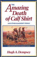 Amazing Death of Calf Shirt