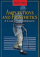 Amputations and Prosthetics: A Case Study Approach