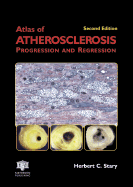 An Atlas of Atherosclerosis Progression and Regression