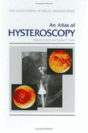 An Atlas of Hysteroscopy