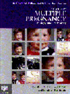 An Atlas of Multiple Pregnancy: Biology and Pathology