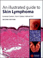 An Illustrated Guide to Skin Lymphoma