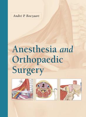 Anesthesia and Orthopaedic Surgery - Boezaart, Andre P (Editor)