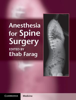 Anesthesia for Spine Surgery - Farag, Ehab (Editor)