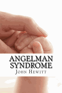 Angelman Syndrome: Causes, Tests, and Treatments