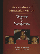 Anomalies of Binocular Vision: Diagnosis and Management