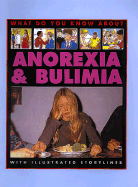 Anorexia and bulimia