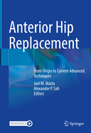 Anterior Hip Replacement: From Origin to Current Advanced Techniques