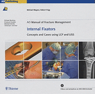 Ao Manual of Fracture Management: Internal Fixators: Concepts and Cases Using Lcp/Liss