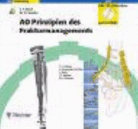 Ao Prinzipien Des Frakturmanagements