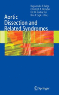 Aortic Dissection and Related Syndromes