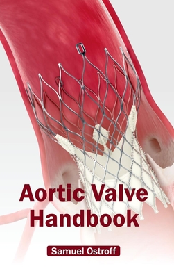 Aortic Valve Handbook - Ostroff, Samuel (Editor)