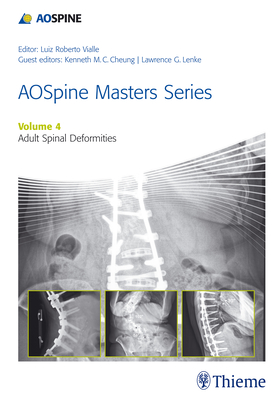 AOSpine Master Series, Vol. 4: Adult Spinal Deformities - Lenke, Lawrence G (Editor), and Cheung, Kenneth M.C. (Editor), and Vialle, Luiz Roberto Gomes (Series edited by)