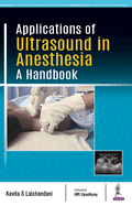 Applications of Ultrasound in Anesthesia: A Handbook