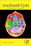 Arachnoid Cysts: Clinical and Surgical Management