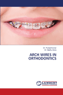 Arch Wires in Orthodontics
