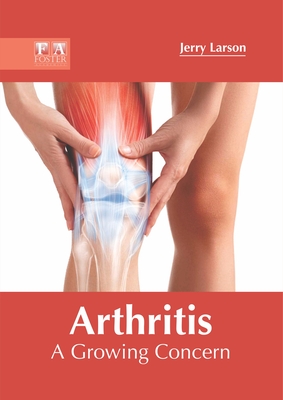 Arthritis: A Growing Concern - Larson, Jerry (Editor)