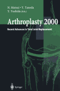 Arthroplasty 2000: Recent Advances in Total Joint Replacement