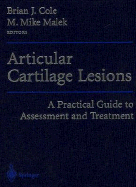 Articular Cartilage Lesions: A Practical Guide to Assessment and Treatment