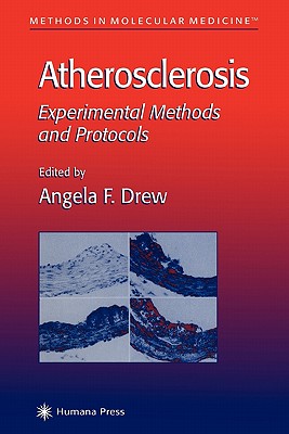 Atherosclerosis: Experimental Methods and Protocols - Drew, Angela F. (Editor)