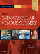 Atlas of Endovascular Venous Surgery