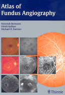 Atlas of Fundus Angiography