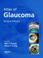 Atlas of Glaucoma, Second Edition