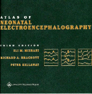 Atlas of Neonatal Electroencephalography