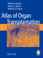 Atlas of Organ Transplantation