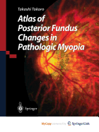 Atlas of Posterior Fundus Changes in Pathologic Myopia