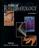 Atlas of Rheumatology - Hunder, Gene G, M.D. (Editor)