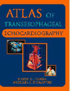Atlas of Transesophageal Echocardiography