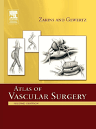 Atlas of Vascular Surgery - Paperback Edition