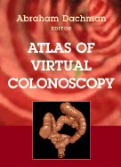 Atlas of Virtual Colonoscopy