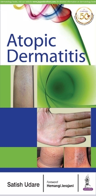 Atopic Dermatitis - Udare, Satish