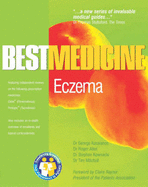 Atopic Eczema: Best Medicine for Atopic Eczema