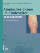 Atopisches Ekzem Im Kindesalter (Neurodermitis): Zeitgem??es Management