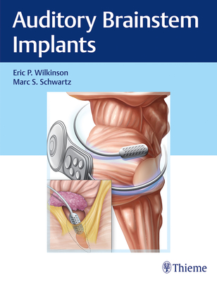 Auditory Brainstem Implants - Wilkinson, Eric P, and Schwartz, Marc S