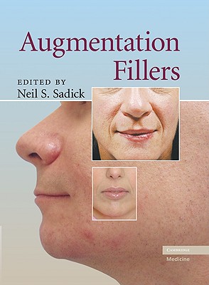 Augmentation Fillers - Sadick, Neil S, MD, Facp (Editor)