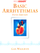 Basic Arrhythmias
