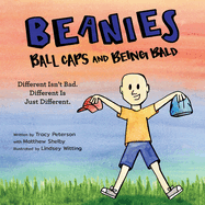 Beanies, Ball Caps, and Being Bald: Different Isn't Bad, Different Is Just Different