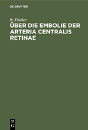 ?ber Die Embolie Der Arteria Centralis Retinae