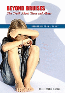 Beyond Bruises: The Truth about Teens and Abuse