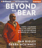 Beyond the Bear: How I Learned to Live and Love Again After Being Blinded by a Bear