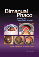 Bimanual Phaco: Mastering the Phakonit/Mics Technique