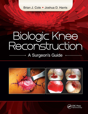 Biologic Knee Reconstruction: A Surgeon's Guide - Cole, Brian, Dr., MD, and Harris, Joshua, MD