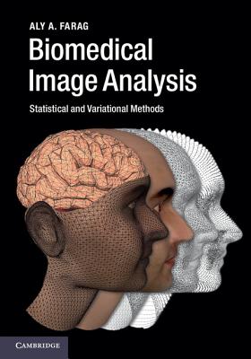 Biomedical Image Analysis: Statistical and Variational Methods - Farag, Aly A.