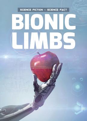 Bionic Limbs - Duhig, Holly